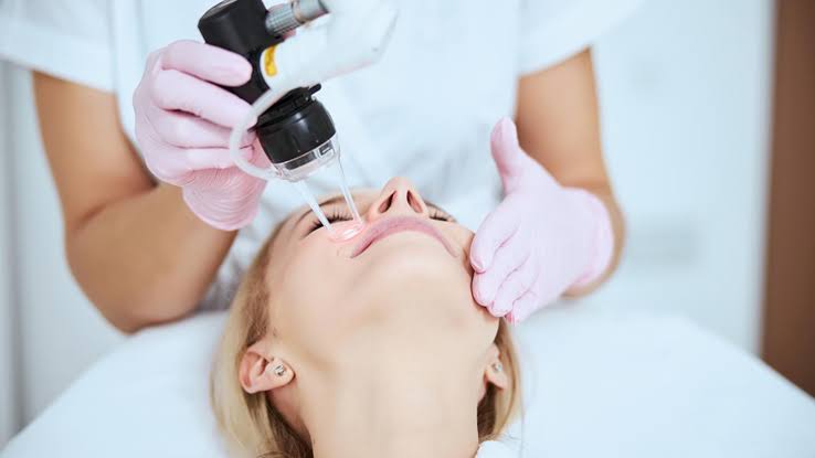 Licensed provider performing CO2 fractional laser treatment on patient’s face at Yeppeun Skin Clinic Dubai