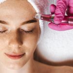 CO2 laser mole and skin tag removal treatment at Yeppeun Skin Clinic, a DHA-licensed aesthetic clinic in Jumeirah 2, Dubai