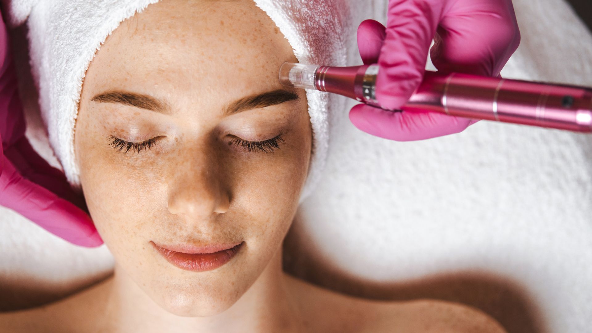 CO2 laser mole and skin tag removal treatment at Yeppeun Skin Clinic, a DHA-licensed aesthetic clinic in Jumeirah 2, Dubai