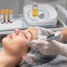PRP Facial Dubai: