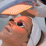Woman receiving Photodynamic Therapy (PDT) light treatment for acne at Yeppeun Skin Clinic in Jumeirah 2, Dubai