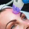 RF microneedling acne extraction treatment session at Yeppeun Skin Clinic, DHA-licensed Korean-standard clinic in Jumeirah 2, Dubai