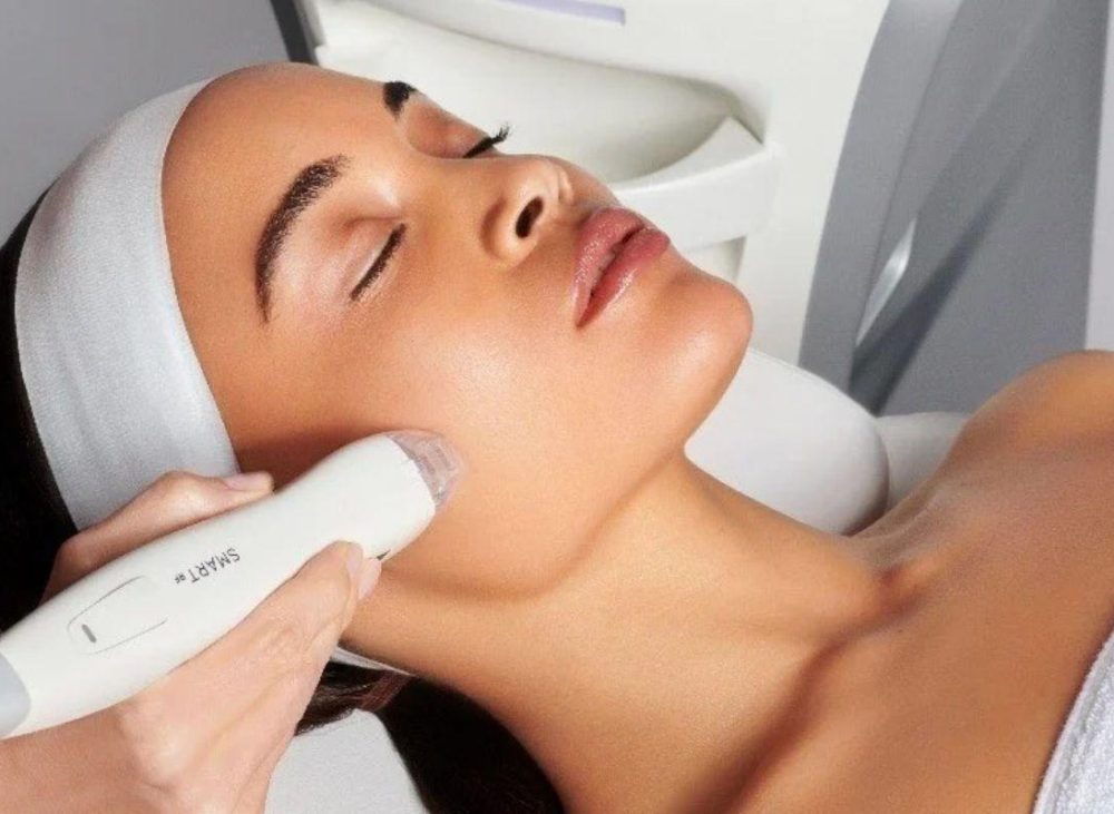 RF microneedling treatment using Virtue Divine Smart Mode device at Yeppeun Skin Clinic, Jumeirah 2, Dubai