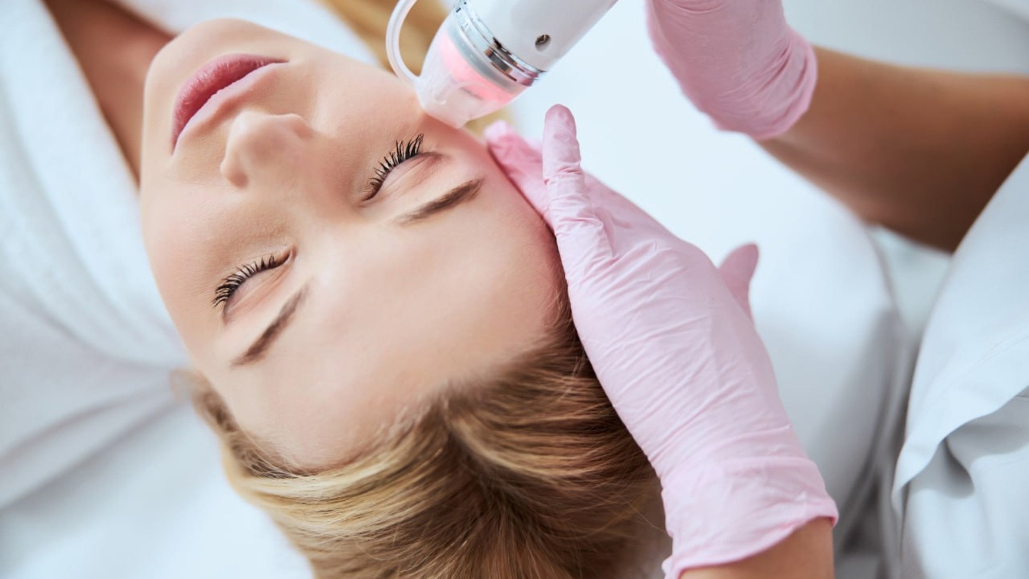 Korean-standard VirtueRF RF microneedling treatment being performed on the face at Yeppeun Skin Clinic, Jumeirah 2, Dubai.
